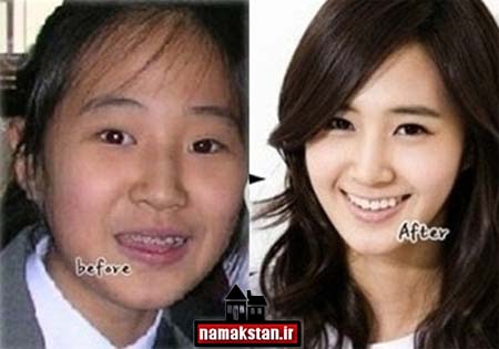 تصاویر و عکس های قبل و بعد از عمل زیبایی بازیگران زن کره