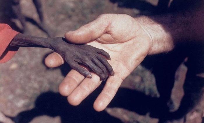 30. A starving child and missionary